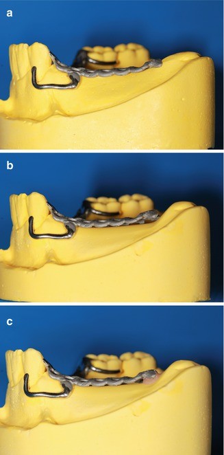 figure 21