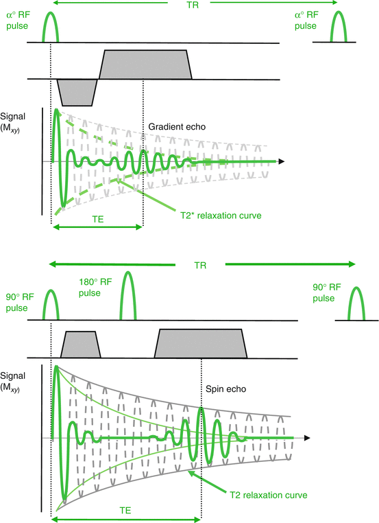 Gradient Echo Versus Spin Echo | SpringerLink