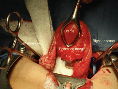 figure 18