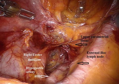 figure 29