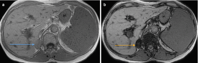 figure 25