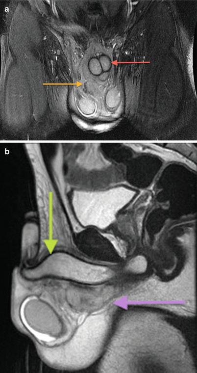 figure 30