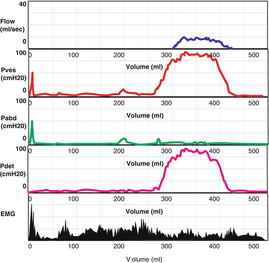 figure 14