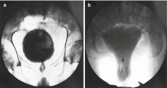 figure 15