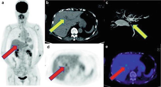 figure 15