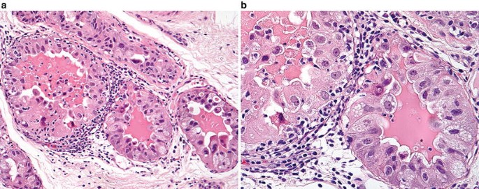 figure 26