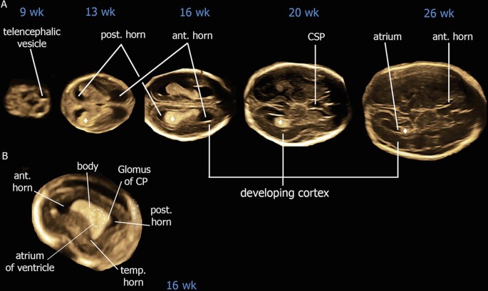 figure 23