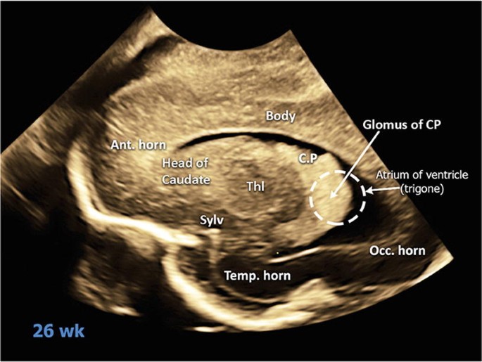 figure 24