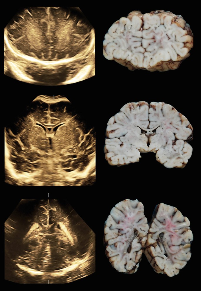 figure 28