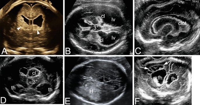 figure 48