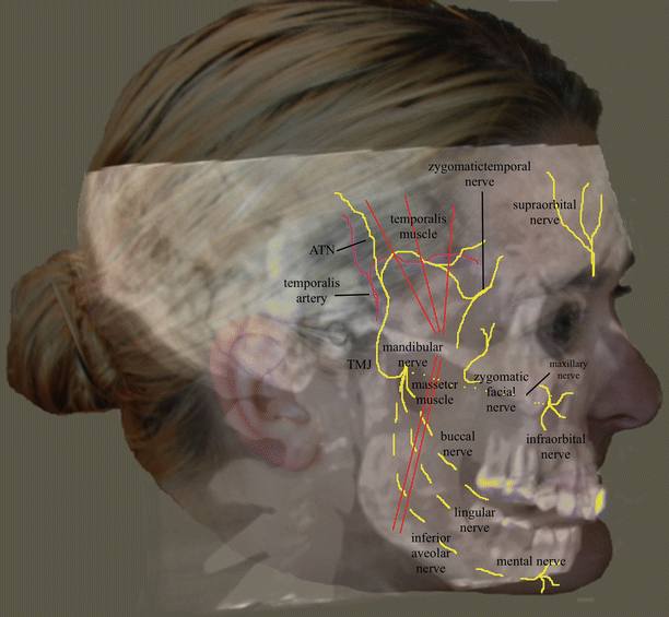 Mandibular Nerve  Complete Anatomy