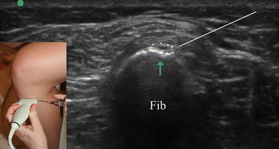 figure 15