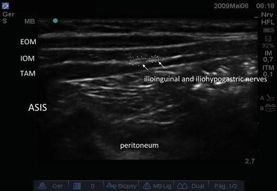 figure 17