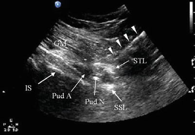 figure 24