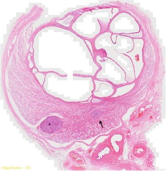 figure 41