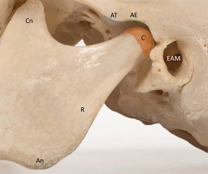 figure 20