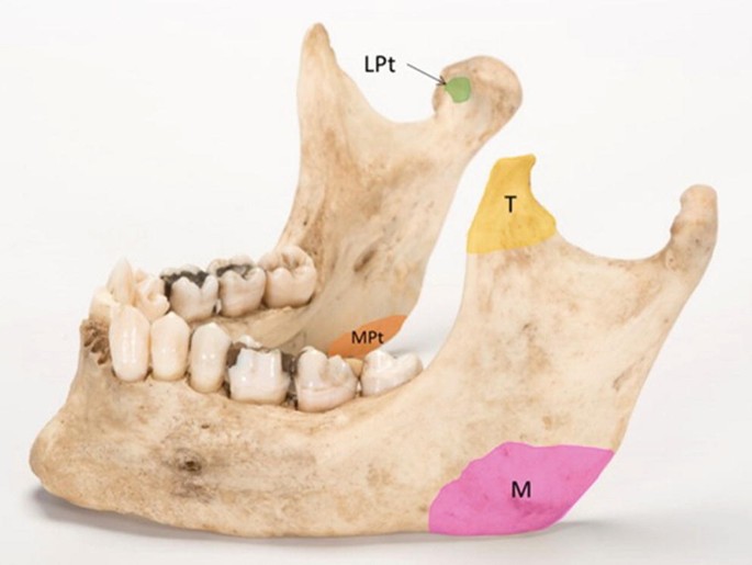 figure 24