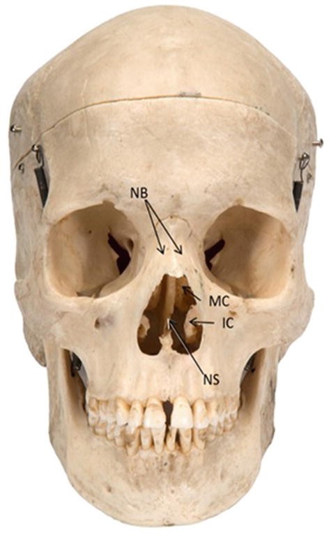 figure 26