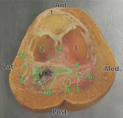 figure 44