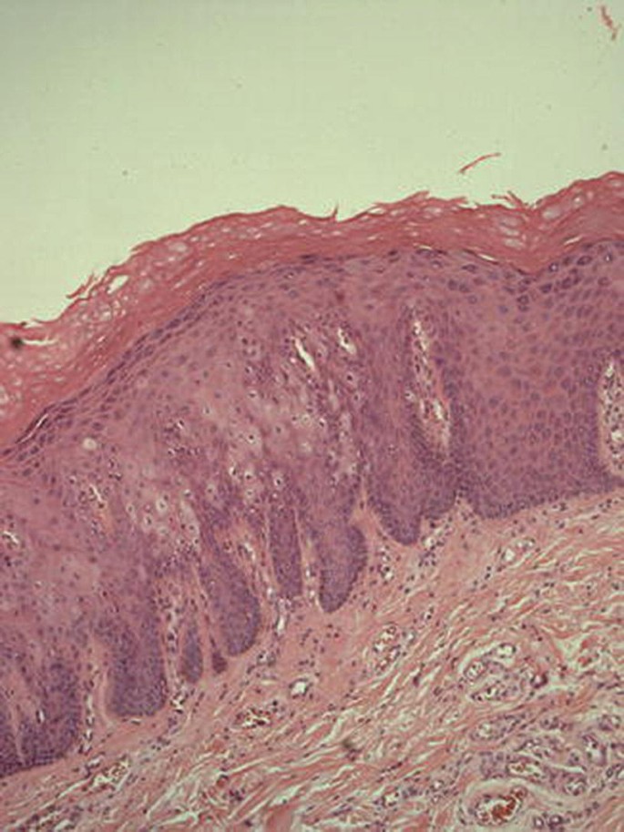 what does tobacco do to your health What smoking does to your bones | UCI Health