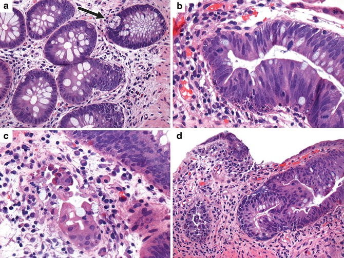 figure 18