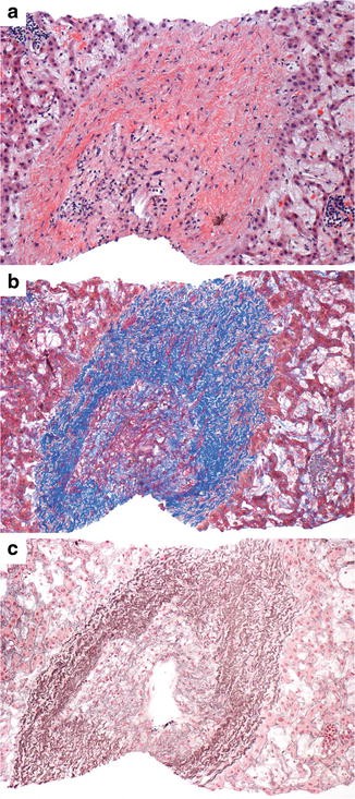 figure 25