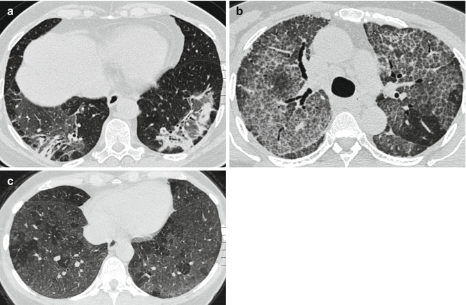 figure 17