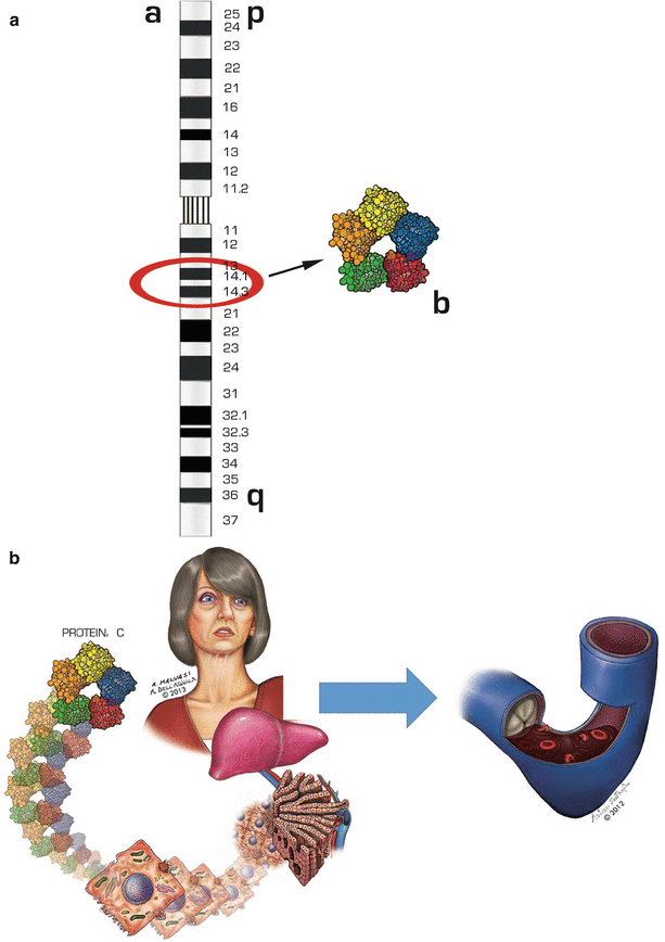 figure 15