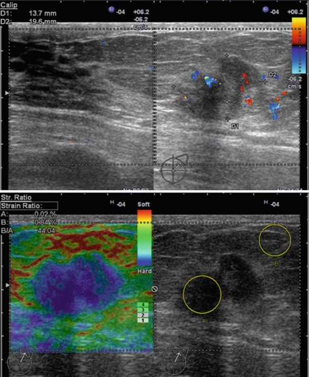 figure 39