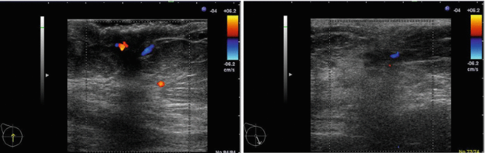 figure 45