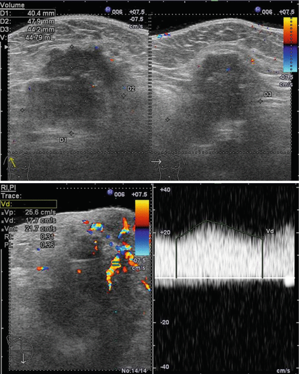 figure 18