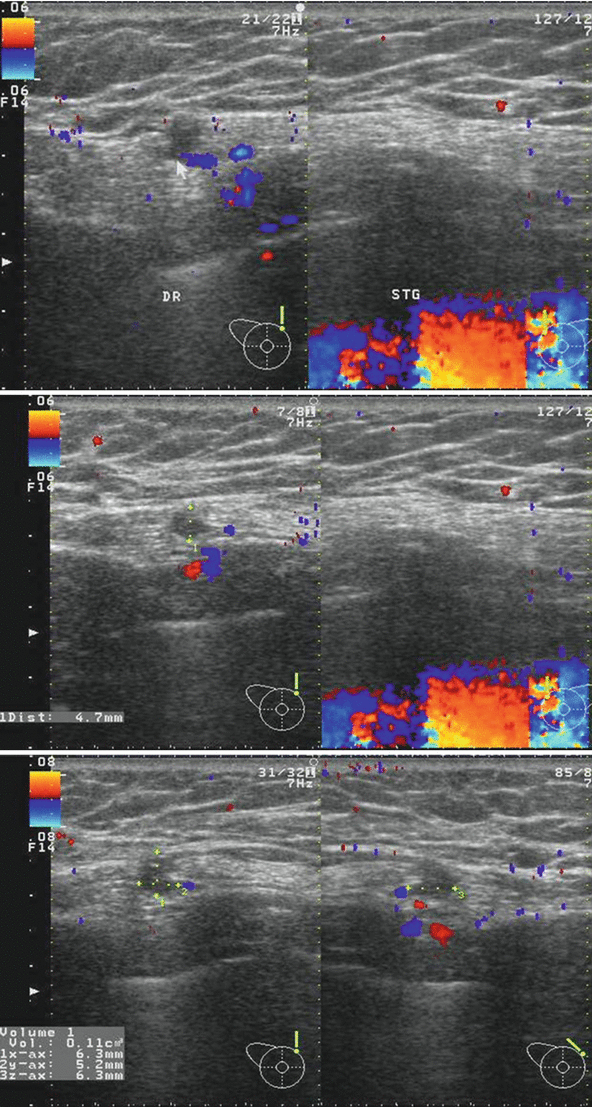 figure 23