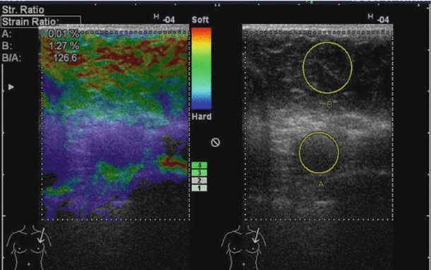 figure 33