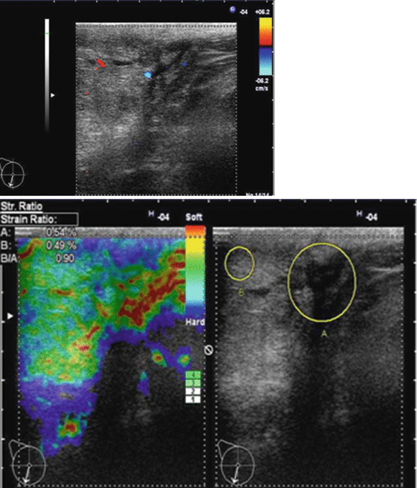 figure 34