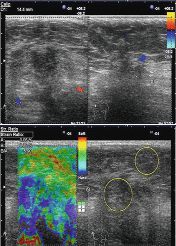 figure 34