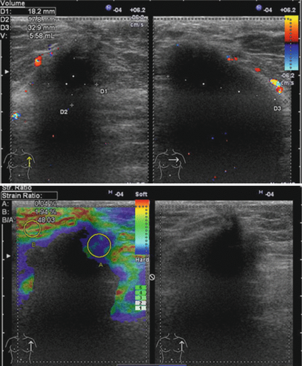 figure 35