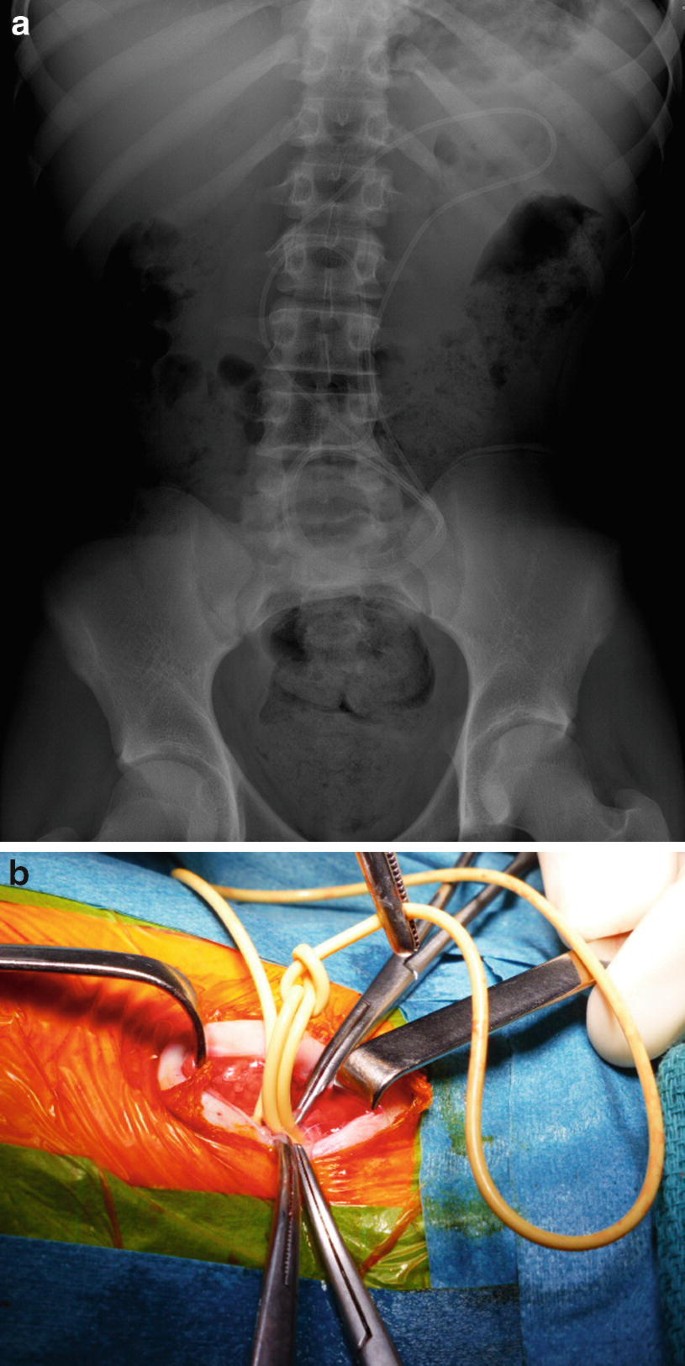 Conflict Responses - CORE, image size:685x1366