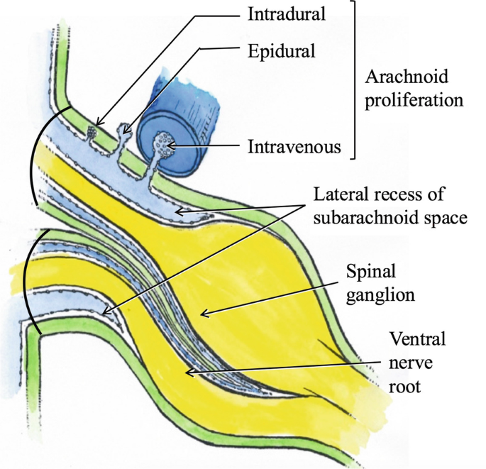 Anatomy of the Cranial and Spinal Meninges | SpringerLink
