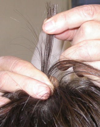Hair Evaluation Method: Pull Test and Wash Test | SpringerLink