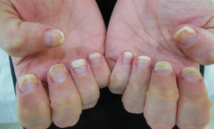 Thumb Knuckle Pain: The Top 6 Possible Causes – The Amino Company