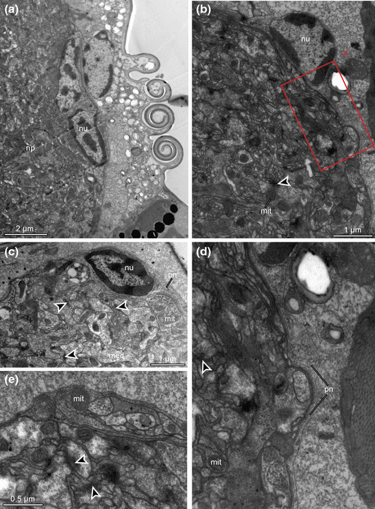 figure 16