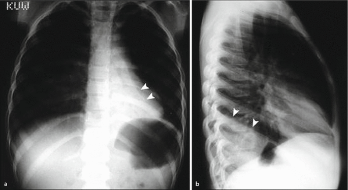 figure 26