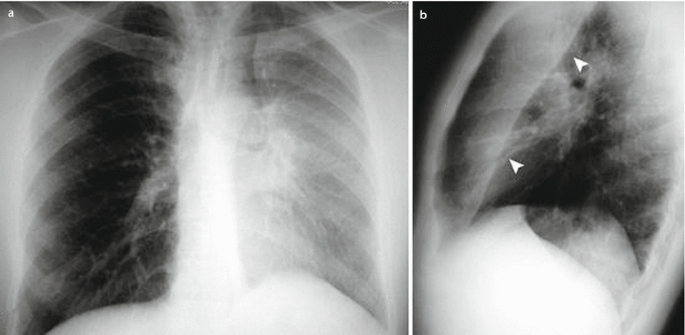 figure 27