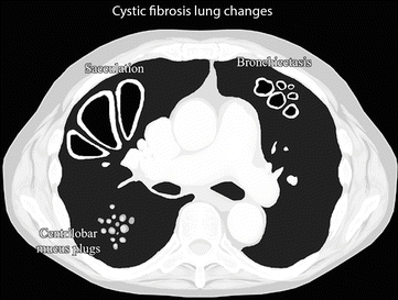 figure 69