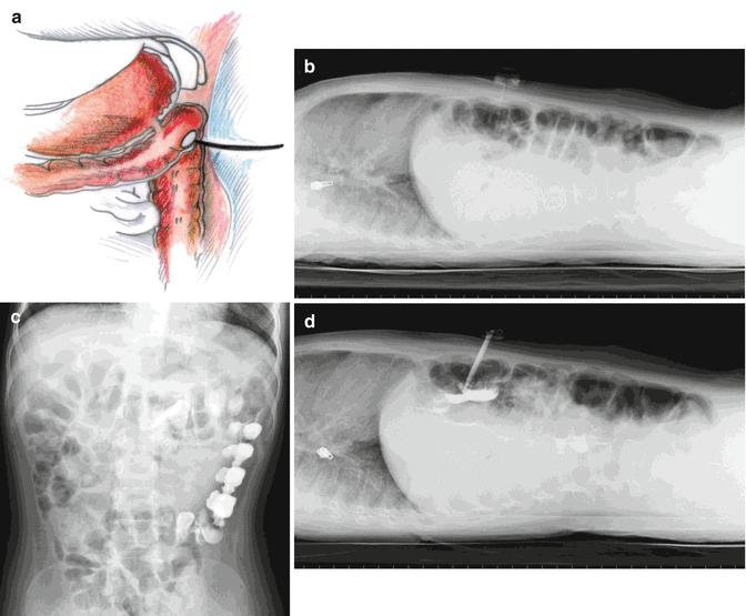 figure 18