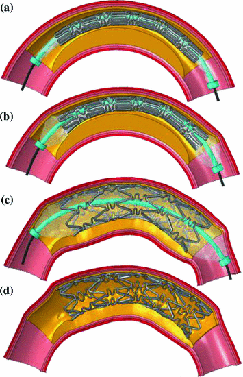 figure 16