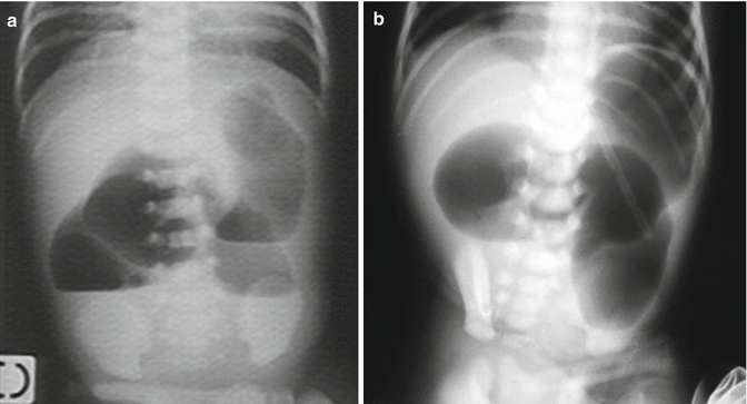 figure 14