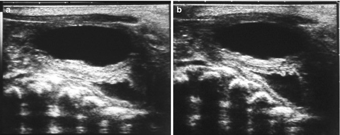 figure 23