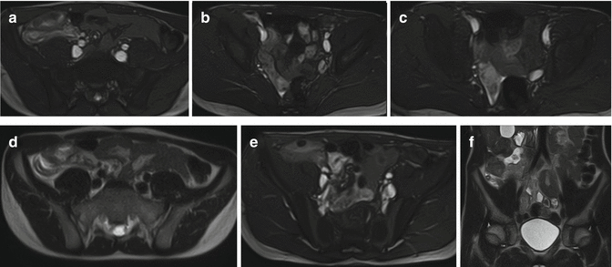 figure 22