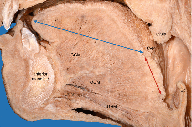 Tongue | SpringerLink